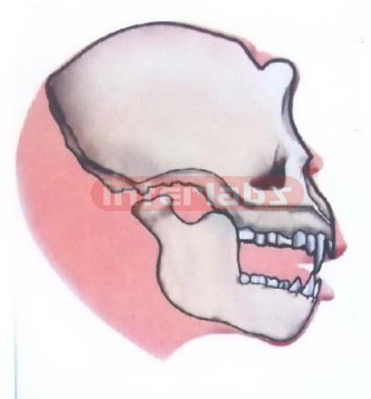 OREOPITHECUS